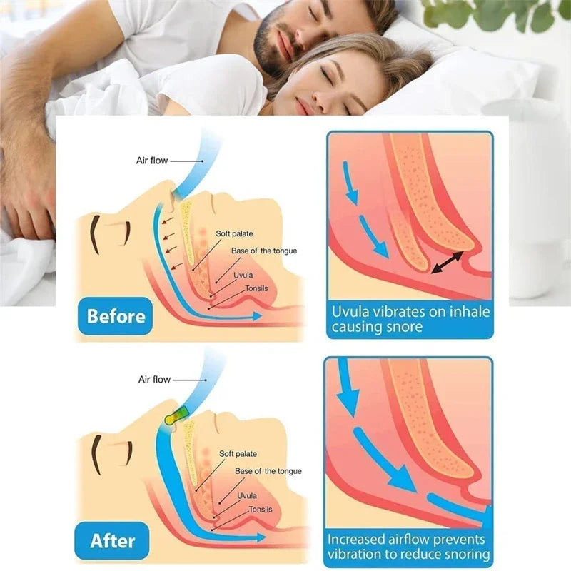 Snoring Nose Clip Anti-Snoring Corrector Snore Prevention Gadget Anti-Snore Device Elimination Nose Clip Men's Sleep Night